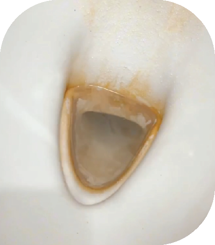 Tips 1 kemeja kuning